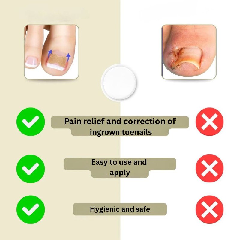 Fast Nail Fix for Broken and Ingrown Nails