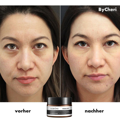 Buy One Get One Free | Anti-Wrinkle Eye Cream for Rejuvenation