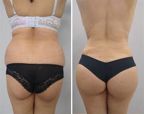 Butt Enhancement Cream Firming & Lifting Shea Butter