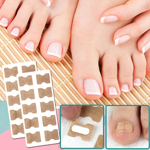 Toenail Alignment Strips for Smooth Appearance | Self-Adhesive Nail Care Patches | Easy Application for Groomed Toenails at Home