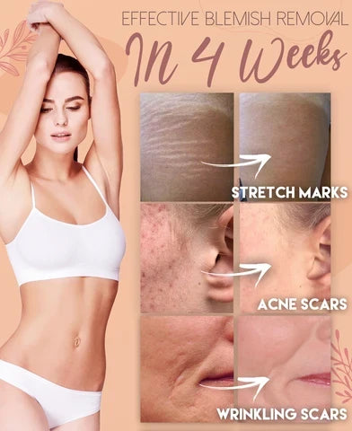 Body Mousse Reduces Stretch Marks Turmeric & Argan Oil