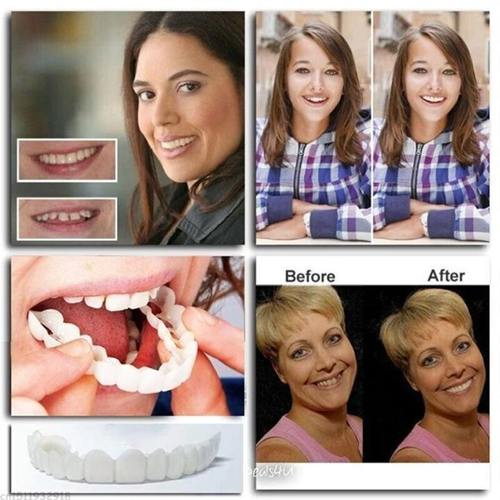 Cosmetic Tooth Veneer Snap-On Cover – Adjustable Fit for Natural-Looking Smile, Removable & Reusable Temporary Smile Enhancement