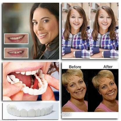 Cosmetic Tooth Veneer Snap-On Cover – Adjustable Fit for Natural-Looking Smile, Removable & Reusable Temporary Smile Enhancement