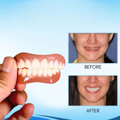 Snap-On Cosmetic Teeth Veneers - Removable Silicone Cover for Instant Smile Makeover, Photo-Ready Confidence