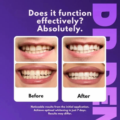 Whitening Strips Purple Tone-Neutralizing 30-Min Treatment