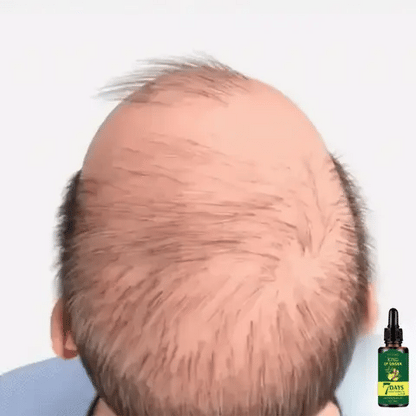 Hair Growth Serum Natural Ginger Extract 30ml