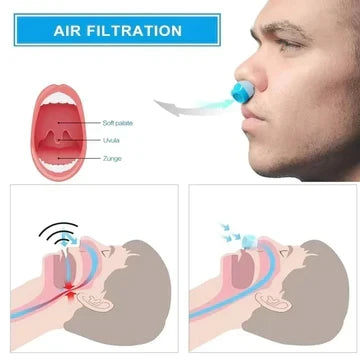 Rechargeable Micro-Fan Sleep Aid Device for Nasal Air Circulation – Cordless, Pocket-Sized Design for Travel, Camping & Hotels