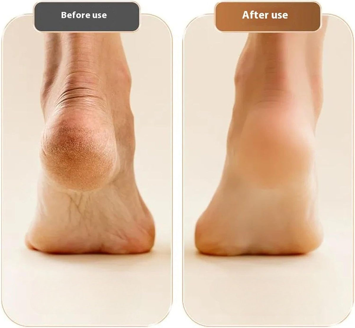 Rechargeable Foot File for Dead Skin & Rough Heels | Professional Pedicure Tool for Smooth Feet at Home