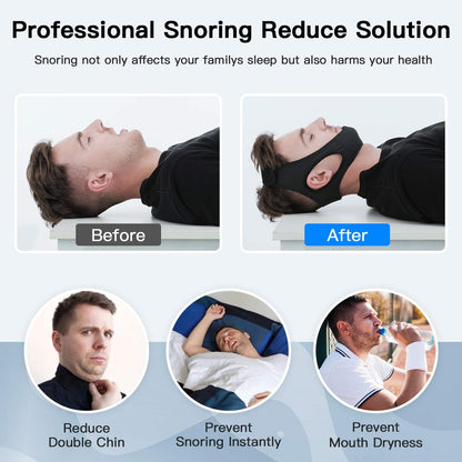 Jaw Support Sleep Band for Mouth Breathing & Nighttime Noise – Adjustable Comfort Strap for Men Women Kids