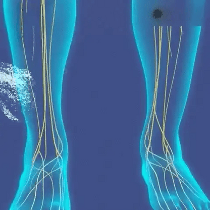 Topical Spray Cooling Joint & Vein Relief