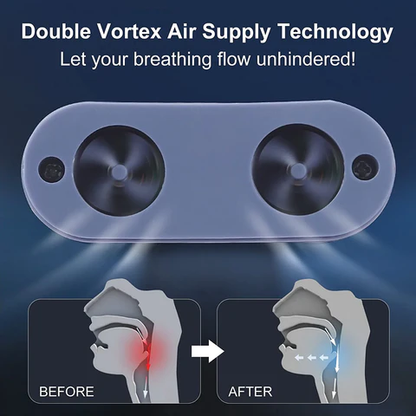 Portable Micro Anti-Snore Sleep Aid Device | USB Rechargeable Nasal Airway Support | Quiet Mask-Free CPAP Alternative for Travel & Home