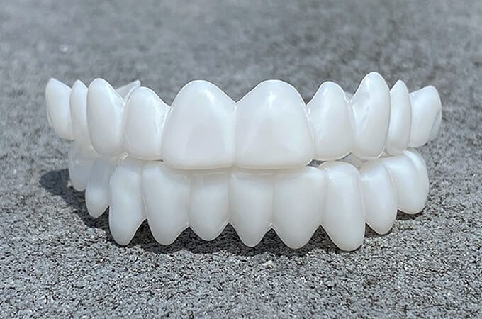SmileLift | Dental Prosthesis with Customizable Lenses for Natural Look | Comfortable Fit for Confident Smiles