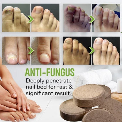 Foot Soak Tablets Herbal Anti-Fungal & Antibacterial