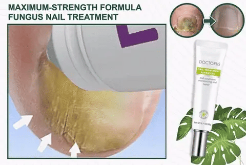 Toenail Gel Antifungal Hydrating 15ml