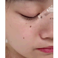 Spot Removal Serum Face & Body Fast-Acting Scar-Free