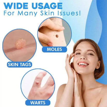 Aero Tag Remover Kit | Pain-Free Skin Tag Solution