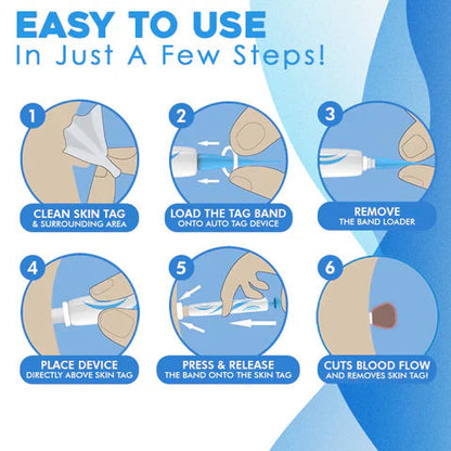 Aero Tag Remover Kit | Pain-Free Skin Tag Solution