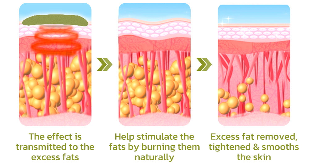 Patch for Reducing Cellulite - Natural Formula