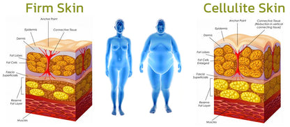 Patch for Reducing Cellulite - Natural Formula
