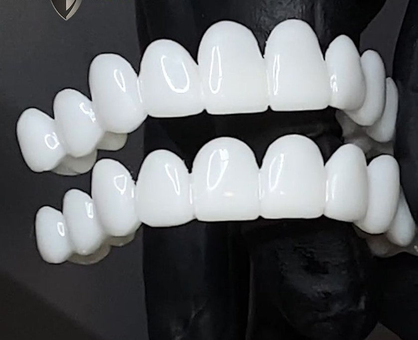 DentAlign | Snap On Teeth Veneers with Custom Fit for Natural Smile