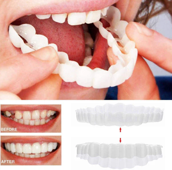 Natural Smile Veneers Upper Lower Teeth Kit - Ortekor