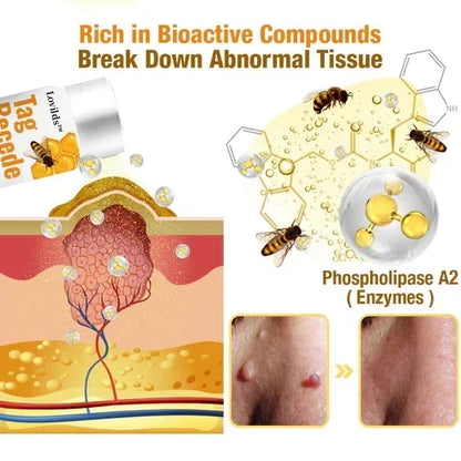 Skin Tag Removal Spray with Natural Bee Venom Extract for At-Home Treatment of Tags, Warts & Moles