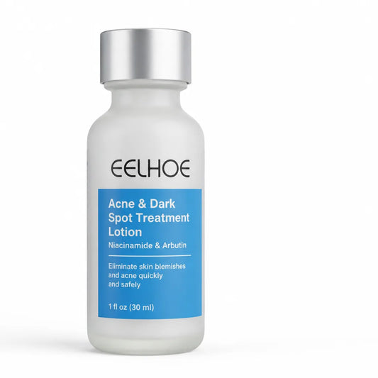 Acne & Dark Spot Treatment Lotion Niacinamide & Arbutin
