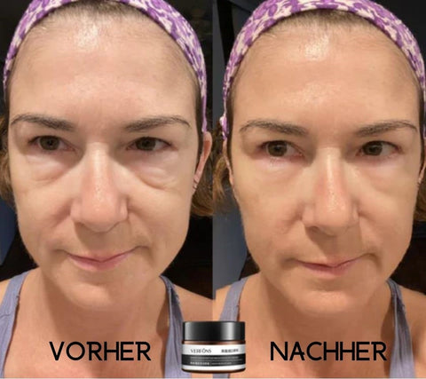 Buy One Get One Free | Anti-Wrinkle Eye Cream for Rejuvenation
