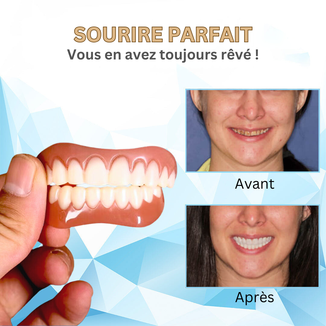 Temporary Cosmetic Teeth Veneers - Moldable Thermal Fit Upper & Lower Denture Smile Kit for Missing Gaps