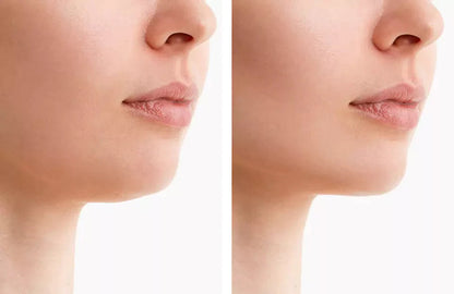 Red Light Therapy Belt | Portable Jaw Sculpting Device for Double Chin Reduction