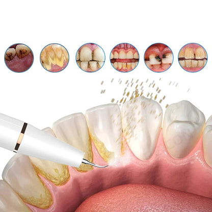 Ultrasonic Tooth Cleaner | Rechargeable Dental Cleaner with Ergonomic Design | Effective Teeth Stain Remover for Home Oral Hygiene