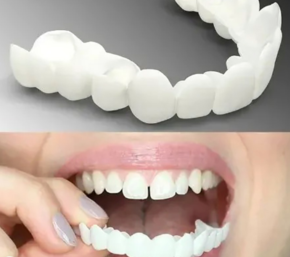 Temporary Cosmetic Teeth Cover Snap-On Upper Veneers Reusable Instant Smile Fix for Adults Comfortable Daily Wear No Dentist Visit Required