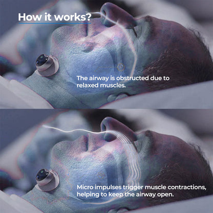 Anti-Snoring Chin Device with Soft Adjustable Ergonomic Design | Comfortable Nighttime Support