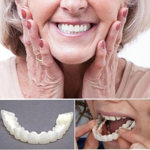 Ultra-Thin Acrylic Open-Palate Removable Veneers (With Molding Kit)