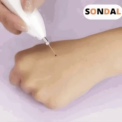Skin Spot Removal Pen Rechargeable Plasma Painless
