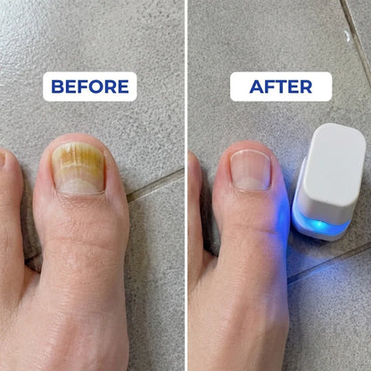 Nail Lamp Dual LED & UV Pain-Free At-Home