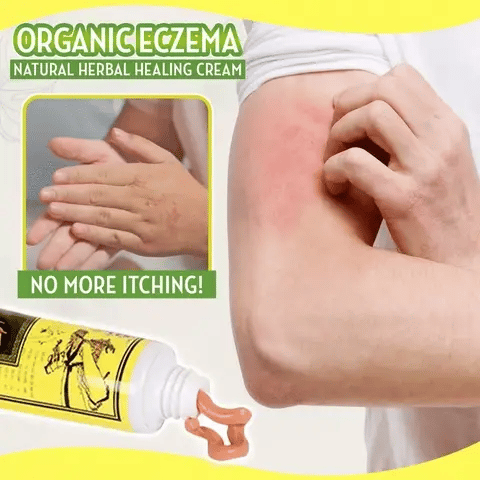 Eczema Healing Cream Organic Steroid-Free Fragrance-Free