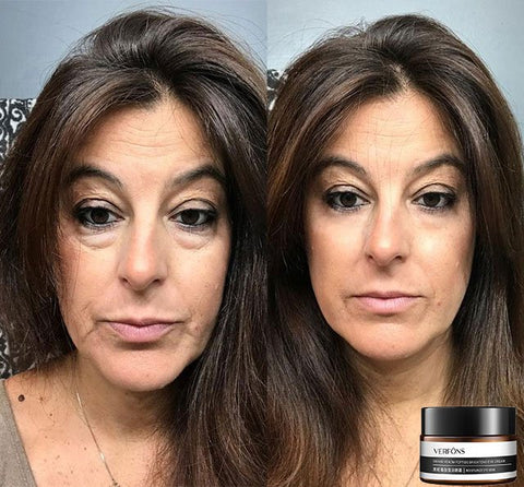 Buy One Get One Free | Anti-Wrinkle Eye Cream for Rejuvenation