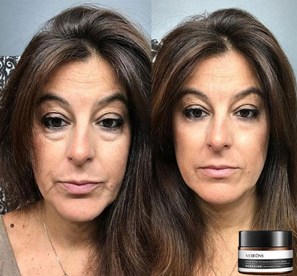 Buy One Get One Free | Anti-Wrinkle Eye Cream for Rejuvenation