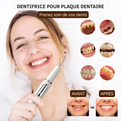Ultrasonic Tooth Cleaner USB Rechargeable for Home Dental Care with LED Light & 3 Power Modes | Tartar Plaque Remover Kit with Stainless