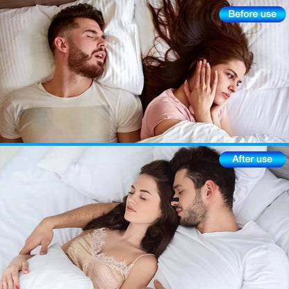 Comfortable Nighttime Nasal Strips for Easy Breathing