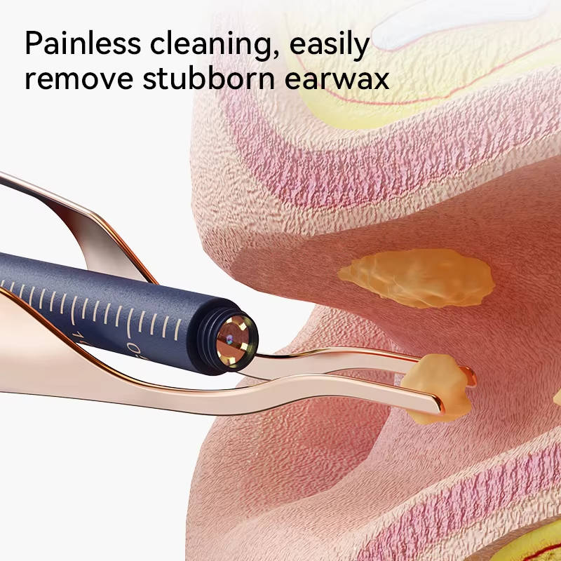 Wireless Ear Scope with HD Video and Travel Case