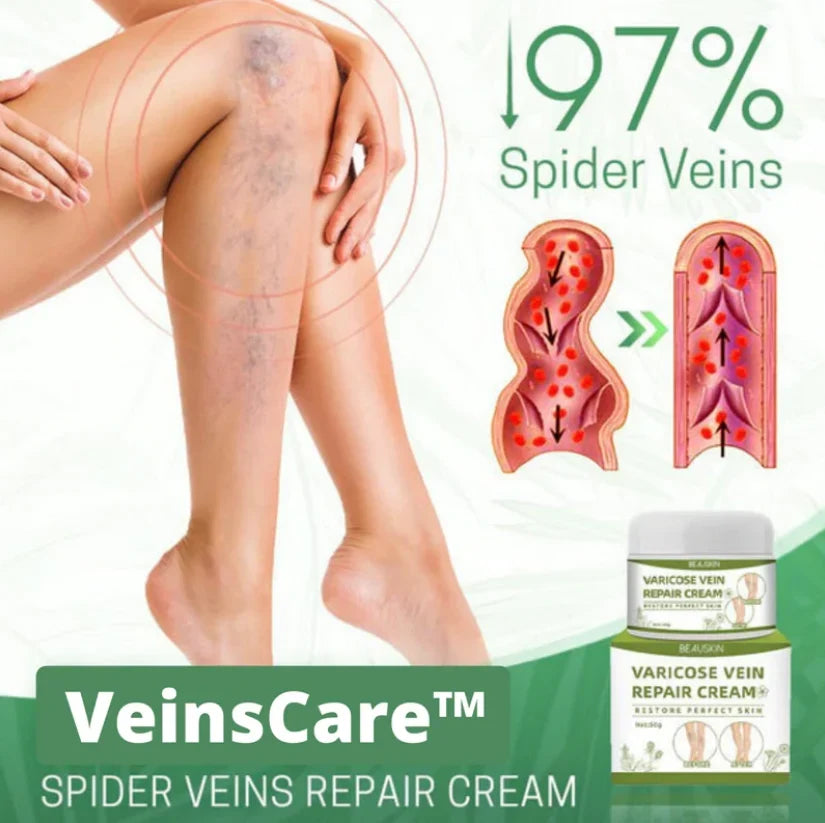 Varicose Vein Cream Reduces Spider Veins Natural & Moisturizing