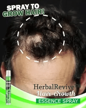 Hair Growth Spray Plant Extracts Thickening & Strengthening