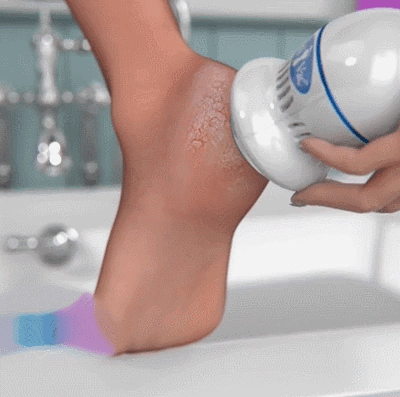Foot Callus Remover Rechargeable Built-In Vacuum Dual Grinding Heads