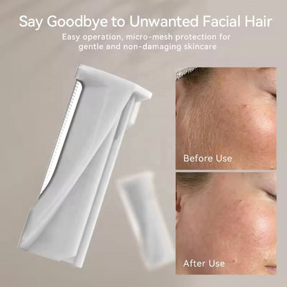 Sonic Facial Exfoliator with LED Light & 3 Speed Settings for Smooth Skin & Peach Fuzz Removal at Home