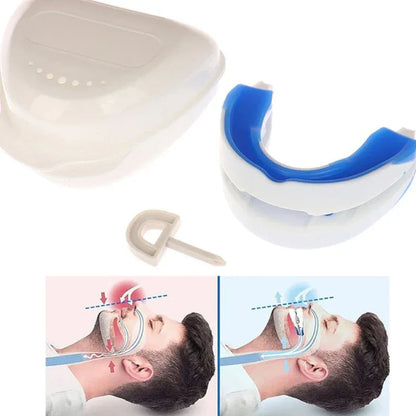 Adjustable Mandibular Advancement Device for Snoring Relief & Better Sleep | Anti-Snore Mouthpiece for Men & Women