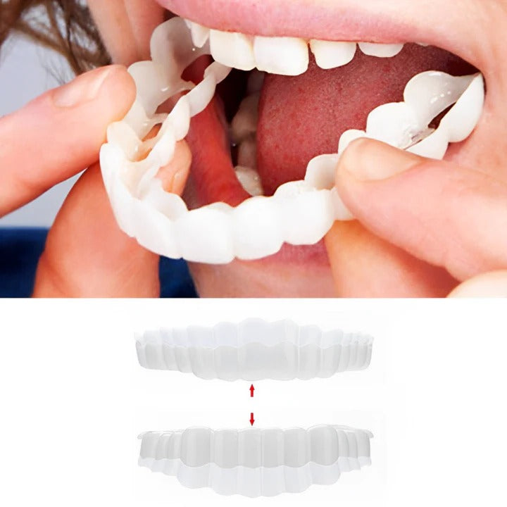 Easy Fit Clip On Smile Veneers Upper Lower Teeth
