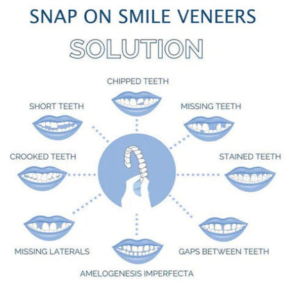 Easy Fit Clip On Smile Veneers Upper Lower Teeth