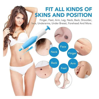 Easy Skin Tag Removal Kit with Applicator